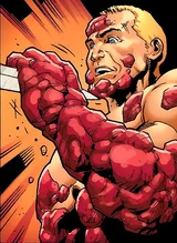 Scab (Earth-616)